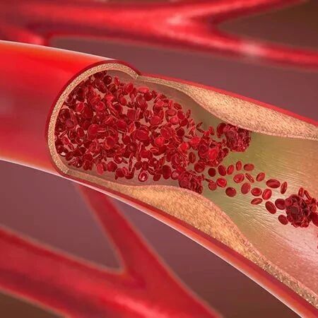 血管里有垃圾，定期输液通血管？医生：这些做法坑你没商量