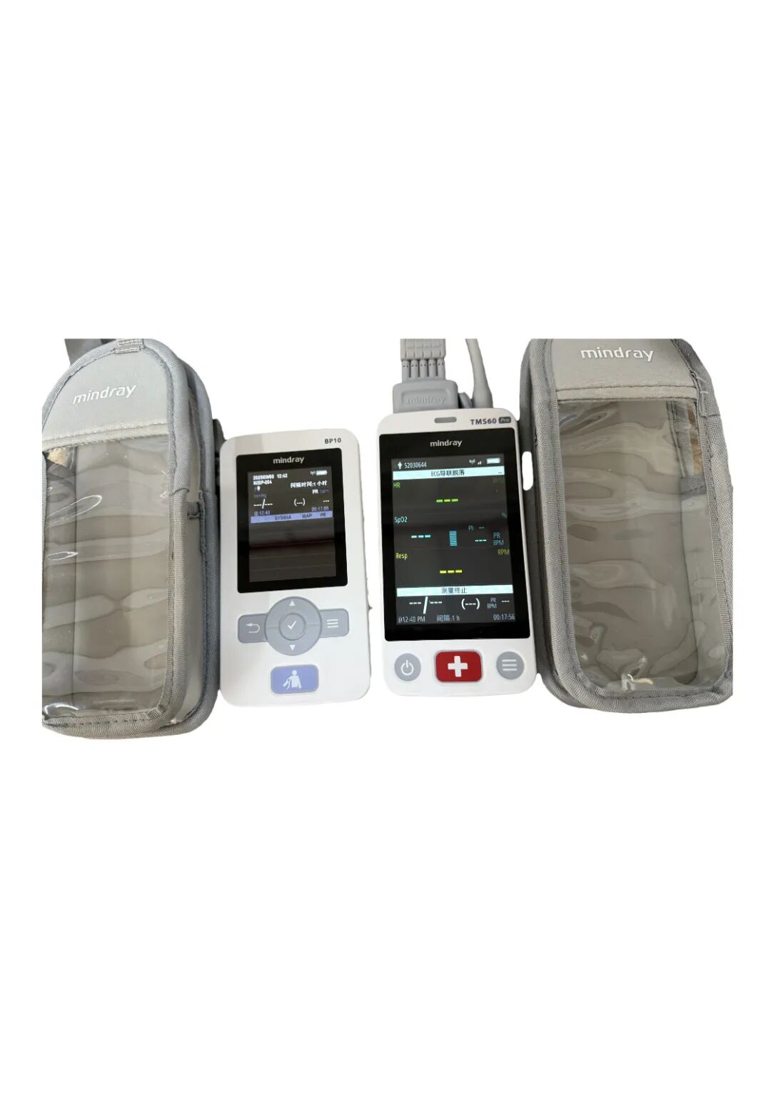 心电监护仪怎么贴遥测心电监护仪：心脏健康的“贴身卫士”_https://www.jmylbn.com_新闻资讯_第8张