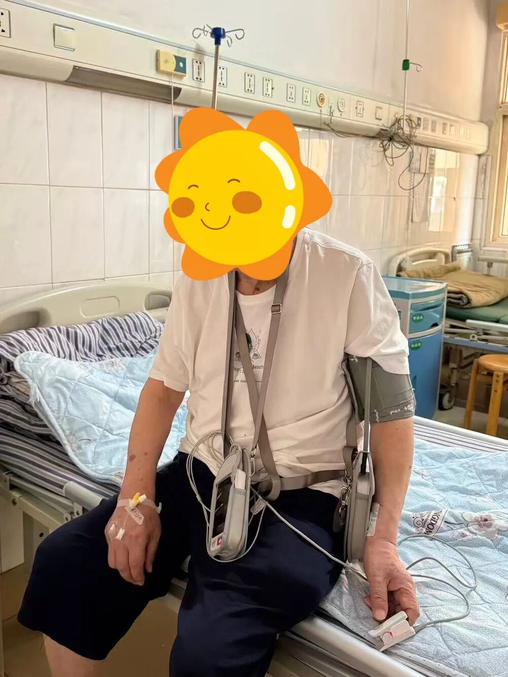 心电监护仪怎么贴遥测心电监护仪：心脏健康的“贴身卫士”_https://www.jmylbn.com_新闻资讯_第5张