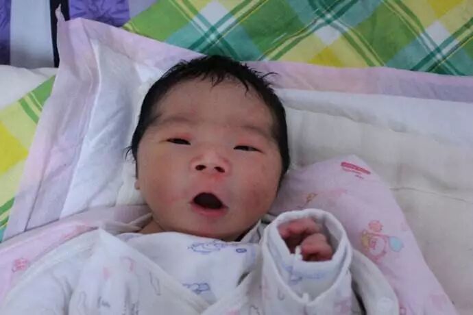 红斑、脱皮、痤疮…新生儿最易出现的10种皮肤问题，月嫂都是这