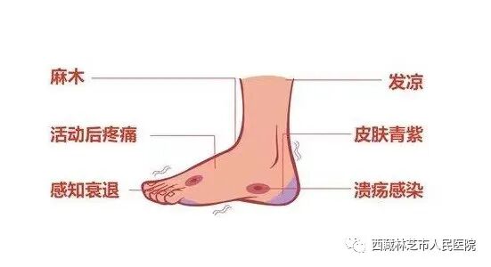 感觉阀值测量怎么测【好消息】我院可以开展感觉阈值测定和四肢动脉多普勒检查，欢迎广大患者朋友咨询！_https://www.jmylbn.com_新闻资讯_第3张