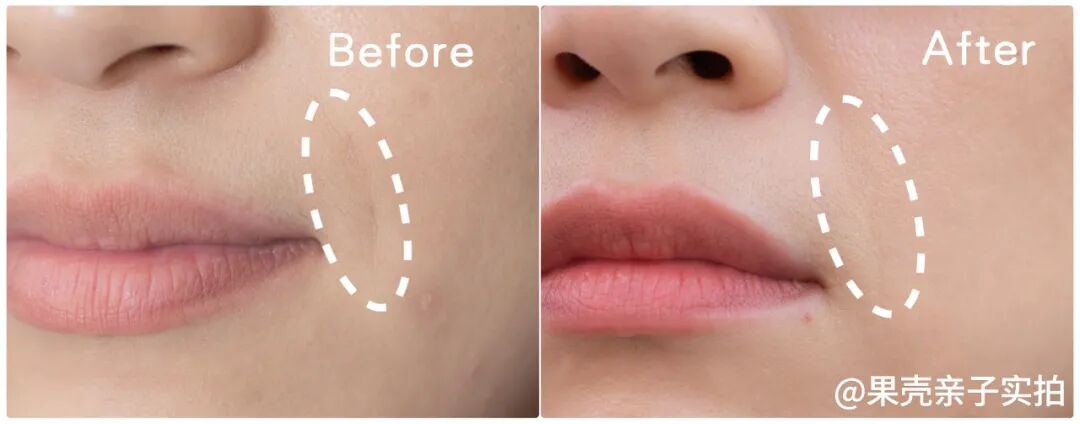 绽媄娅的产品怎么样哪有什么“断崖式衰老”，卷医美不如做好这件事_https://www.jmylbn.com_新闻资讯_第11张