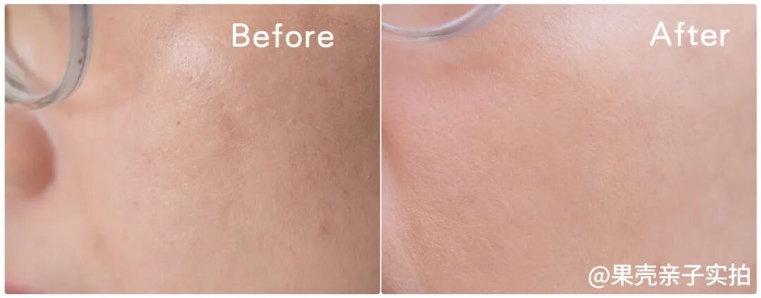 绽媄娅的产品怎么样哪有什么“断崖式衰老”，卷医美不如做好这件事_https://www.jmylbn.com_新闻资讯_第42张
