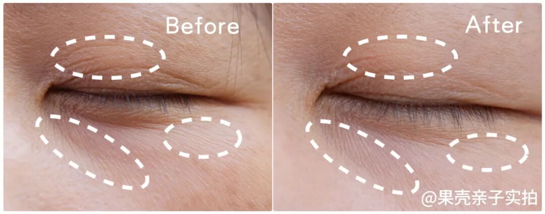 绽媄娅的产品怎么样哪有什么“断崖式衰老”，卷医美不如做好这件事_https://www.jmylbn.com_新闻资讯_第10张