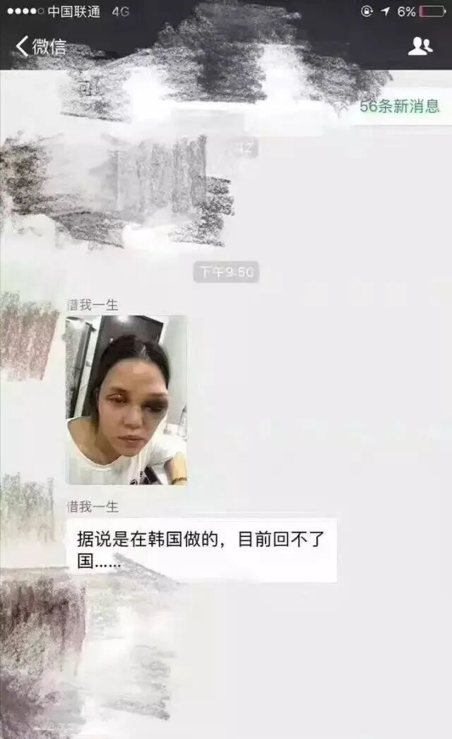 看脸的时代 整了就赢了 整形失败案例暴增 整形有风险 爱美需谨慎 宁波新闻