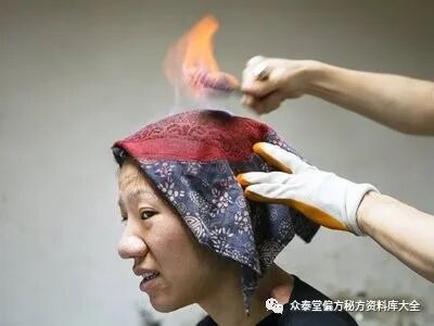 中医熨烫怎么中医药熨疗法大全_https://www.jmylbn.com_新闻资讯_第7张