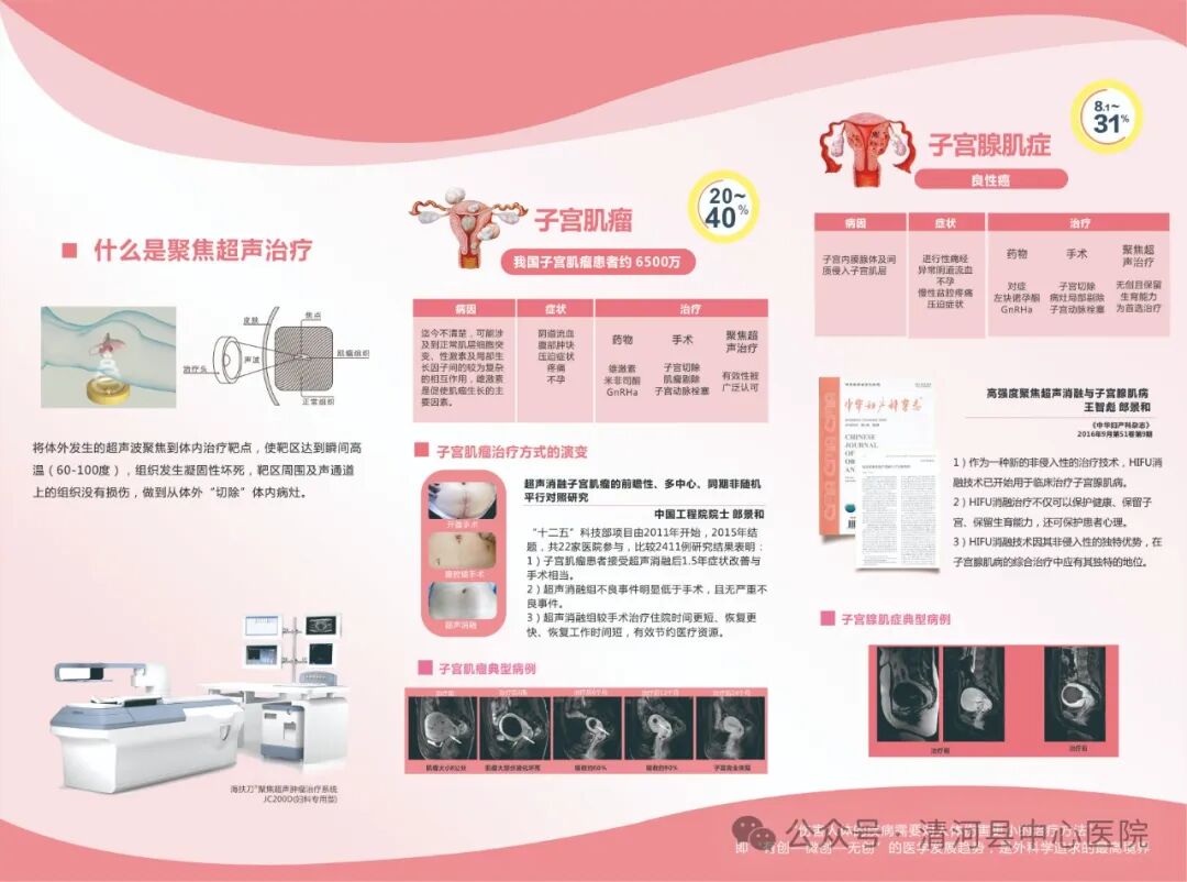 什么叫海扶刀“无创治疗”独门绝技——海扶刀_https://www.jmylbn.com_新闻资讯_第5张