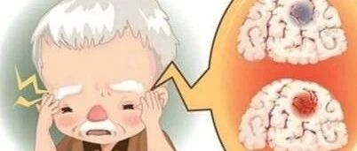 近30年来，国人的头号死因都是它！