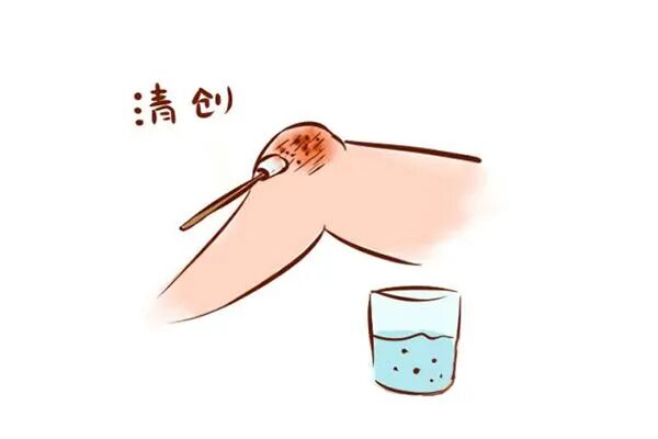 伤口凝胶敷料怎么用孩子伤口结痂，采用这些敷料换药不疼、恢复快！_https://www.jmylbn.com_新闻资讯_第3张