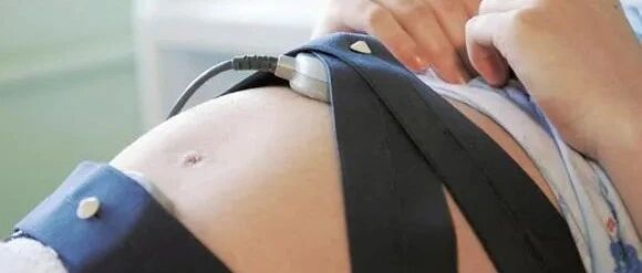 胎心监护不就是听宝宝心跳？有必要每周都做吗？