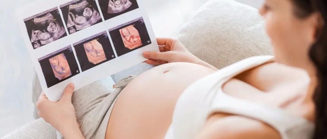 【干货】四维数据看不懂？送你一份超声影像（四维彩超）名词解析单！