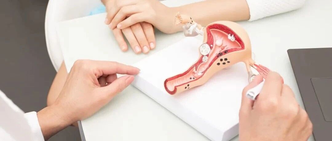 医生，我下面有虫！