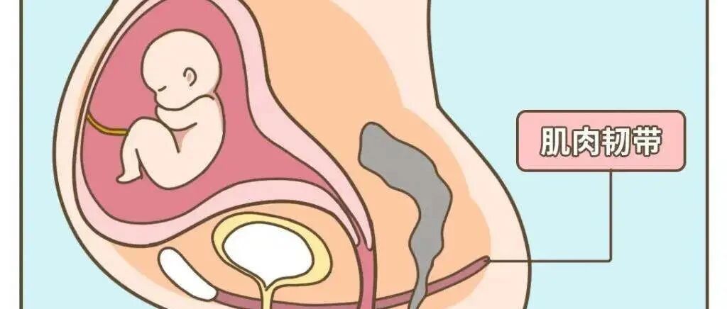 比起剖宫产，你真的认为顺产会让盆底肌更松弛？