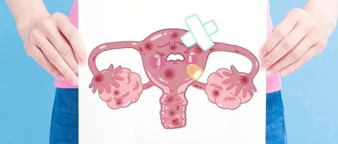 每4个女人就有1个患子宫肌瘤，这瘤子到底有多可怕？