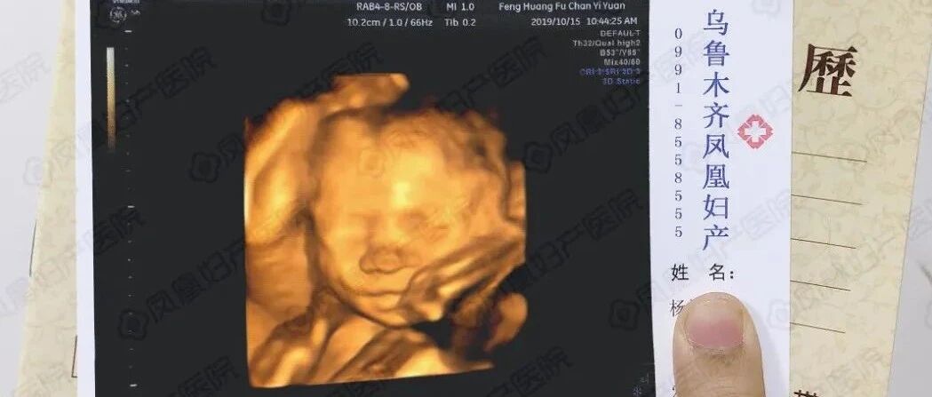 春节后孕妈们一定要做的一项重要检查，可别疏忽大意了！