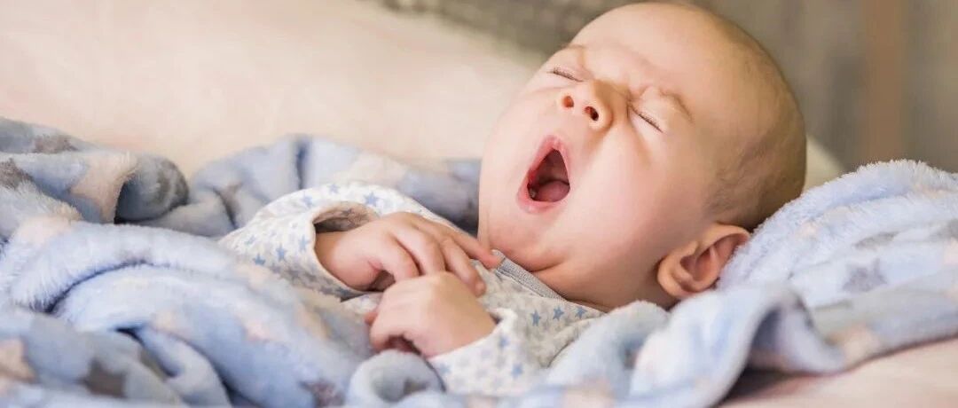 我的宝宝怎么变成了“小黄人”？