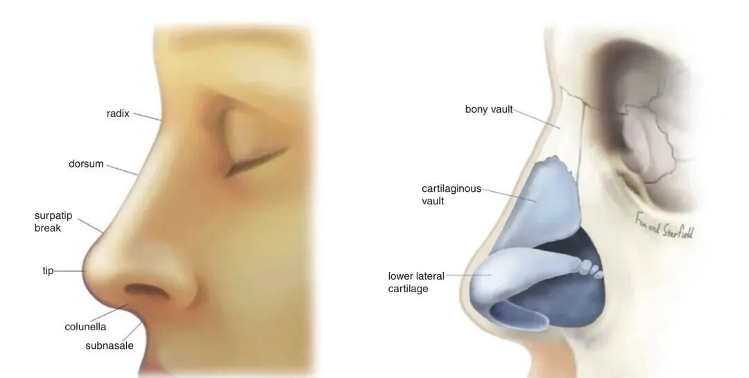 什么是骨锉“驼峰鼻”长什么样？_https://www.jmylbn.com_新闻资讯_第3张