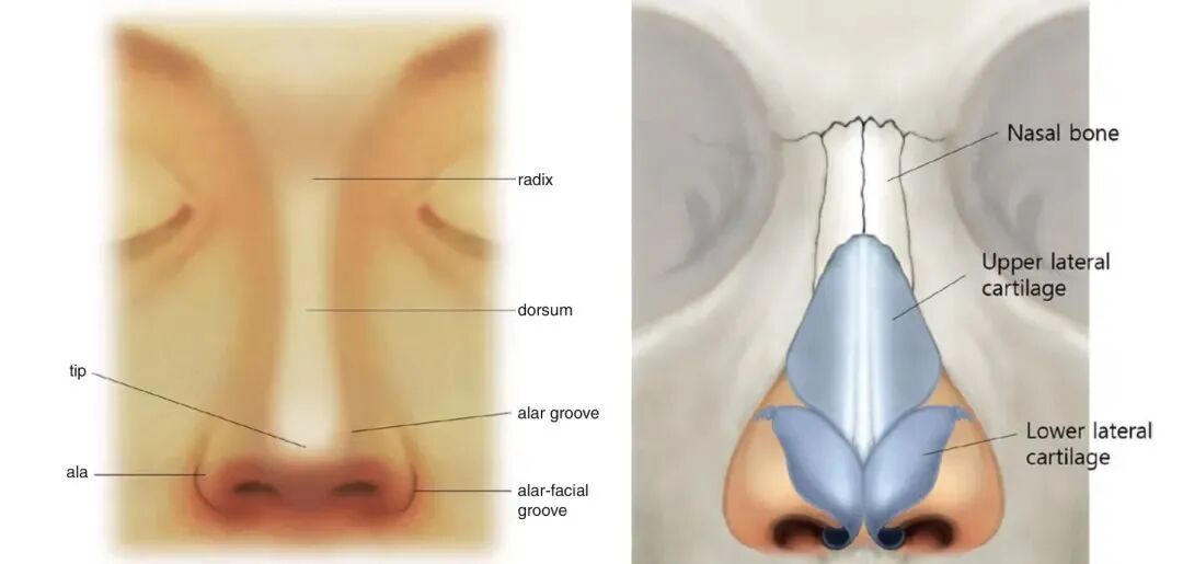 什么是骨锉“驼峰鼻”长什么样？_https://www.jmylbn.com_新闻资讯_第2张