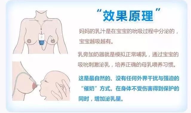 母乳本艰难 追奶 乳头混淆一个问题接一个问题 乳旁加奶器用起来 还给宝宝37 的爱 口袋育儿 微文库
