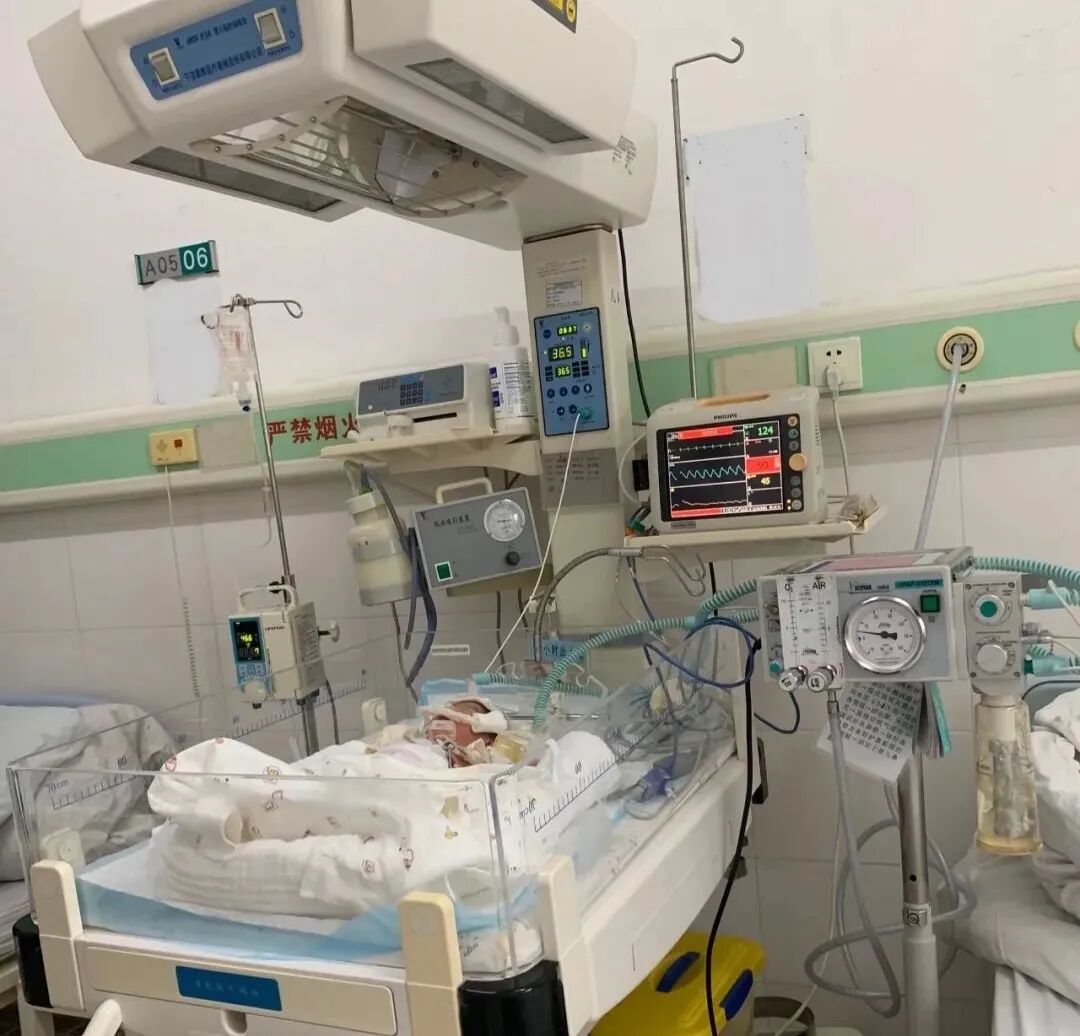 儿科CPAP为什么镇静【医疗技术】龙湖区医共体集团总院儿科应用鼻塞式CPAP治疗早期新生儿肺透明膜病_https://www.jmylbn.com_新闻资讯_第5张