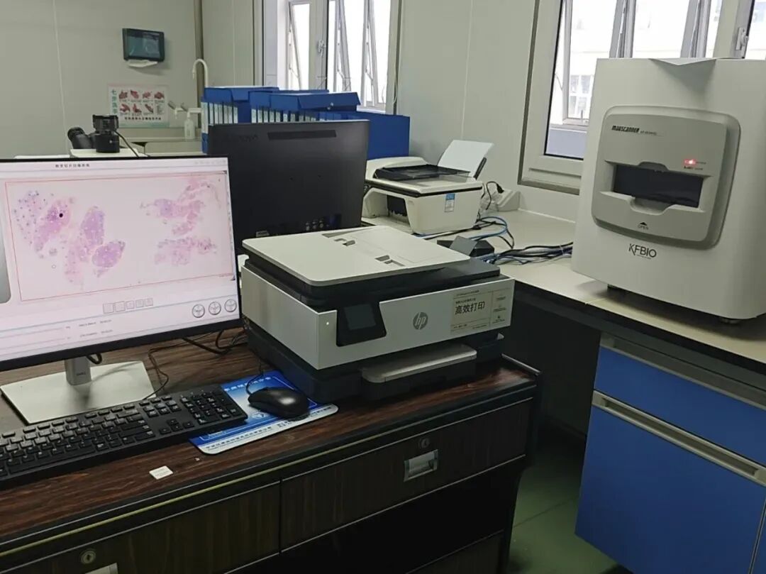 lct怎么检查【医学科普】宫颈液基细胞学（TCT／LCT）检查报告不会看？一图教会你读懂_https://www.jmylbn.com_新闻资讯_第27张
