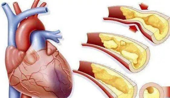 【中国心梗救治日】中国心梗救治日——心梗拨打120，胸痛中心快救命，附：宣传视频