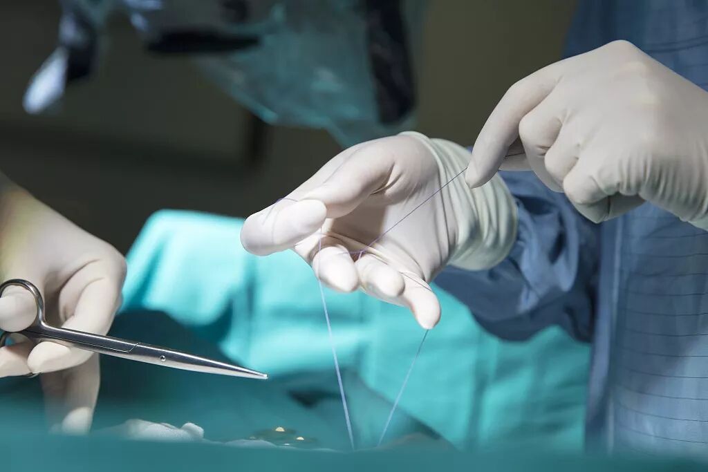 缝线怎么吸收【医疗知识】外科缝线知多少？这篇文章讲全了！_https://www.jmylbn.com_新闻资讯_第1张