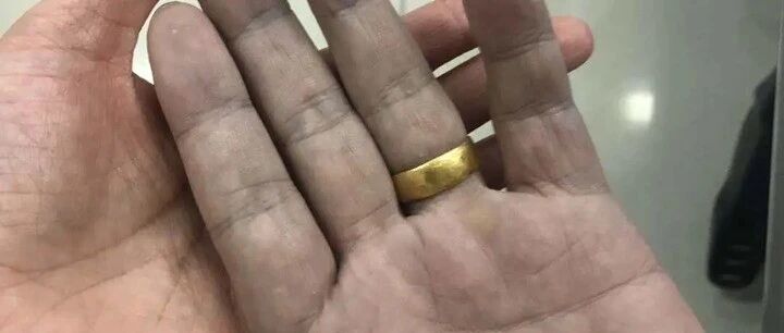 杭州人最近爱吃的这种美食，52岁大伯吃掉满满一盆后“变紫了”，脾气暴躁还尿裤子！