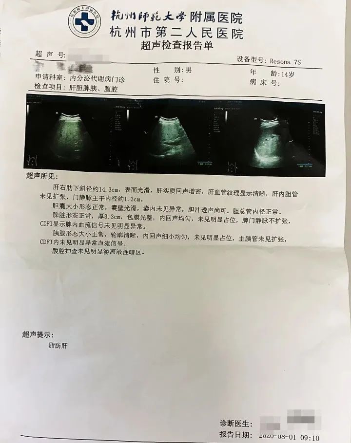 都是14岁 平均体重178斤 暑假杭州这个门诊小胖墩扎堆 怎么看是胖还是壮 都市快报 微信公众号文章阅读 Wemp