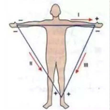 心电图怎么切换导联【干货】肢体导联电极错接的心电图分析及鉴别（上）：四夹子导联_https://www.jmylbn.com_新闻资讯_第3张