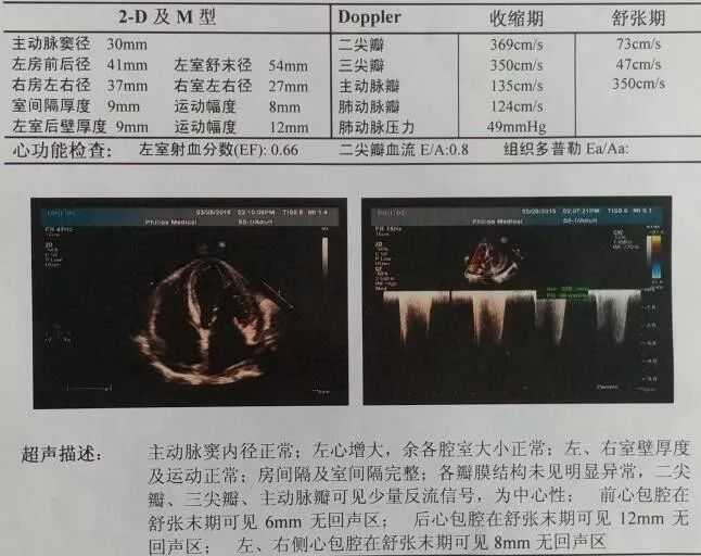 在線心內會診室丨水腫、高血壓、泡沫尿，門診著名專家說是疑難雜症？ 健康 第3張