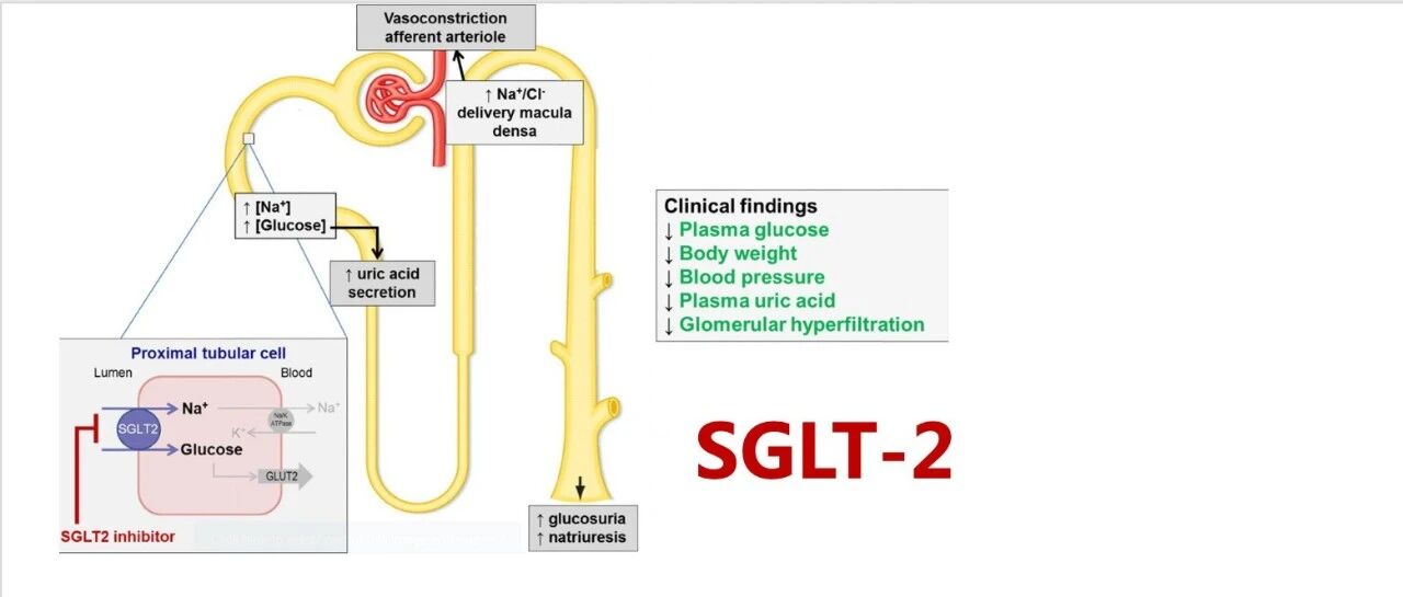 干货丨SGLT-2抑制剂与射血分数降低心衰：研究证据与临床启示