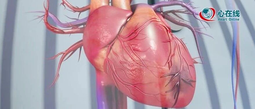 干货丨急性心梗心电图，各阶段特点汇总分析