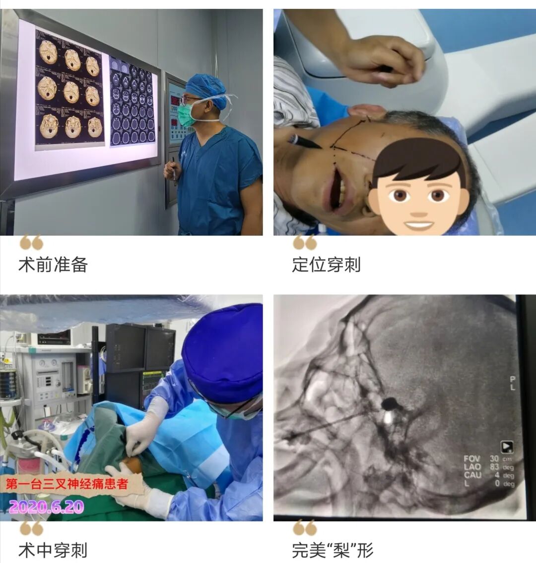 疼痛好几年 灭 痛 分分钟 看神经外科的幻影神针 云南特产网