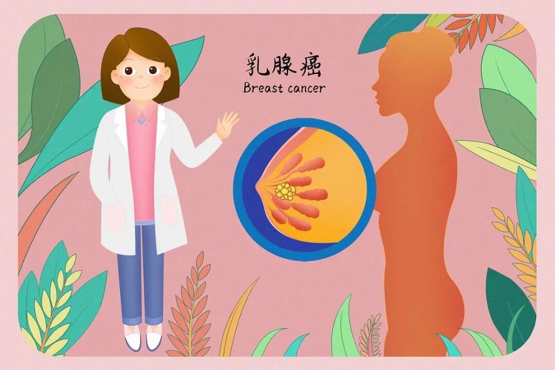 全国肿瘤防治宣传周预防乳腺癌知识您知道多少