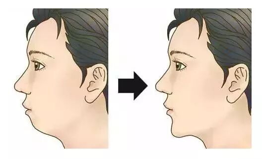 这4类人牙齿矫正，脸型变化最大！