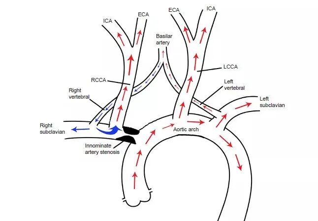 外展枕怎么使用中枢神经系统解剖定位诊断【大全】_https://www.jmylbn.com_新闻资讯_第115张