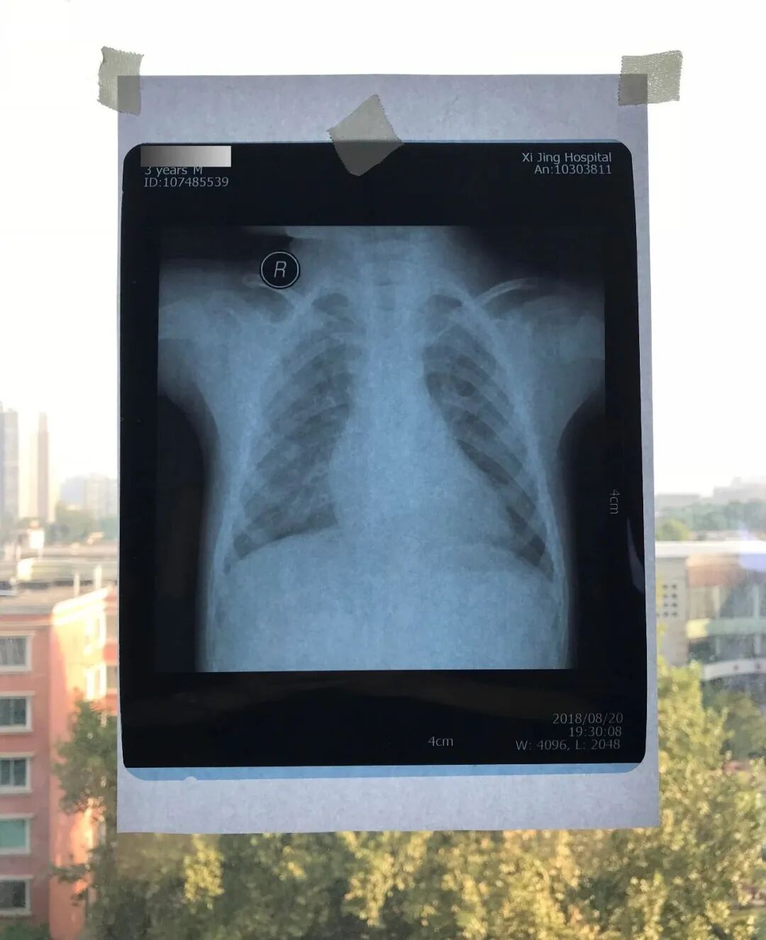 ct打印胶片怎么用远程就医、转院就医时，CT核磁DICOM电子胶片的重要性！【就医知识】_https://www.jmylbn.com_新闻资讯_第5张