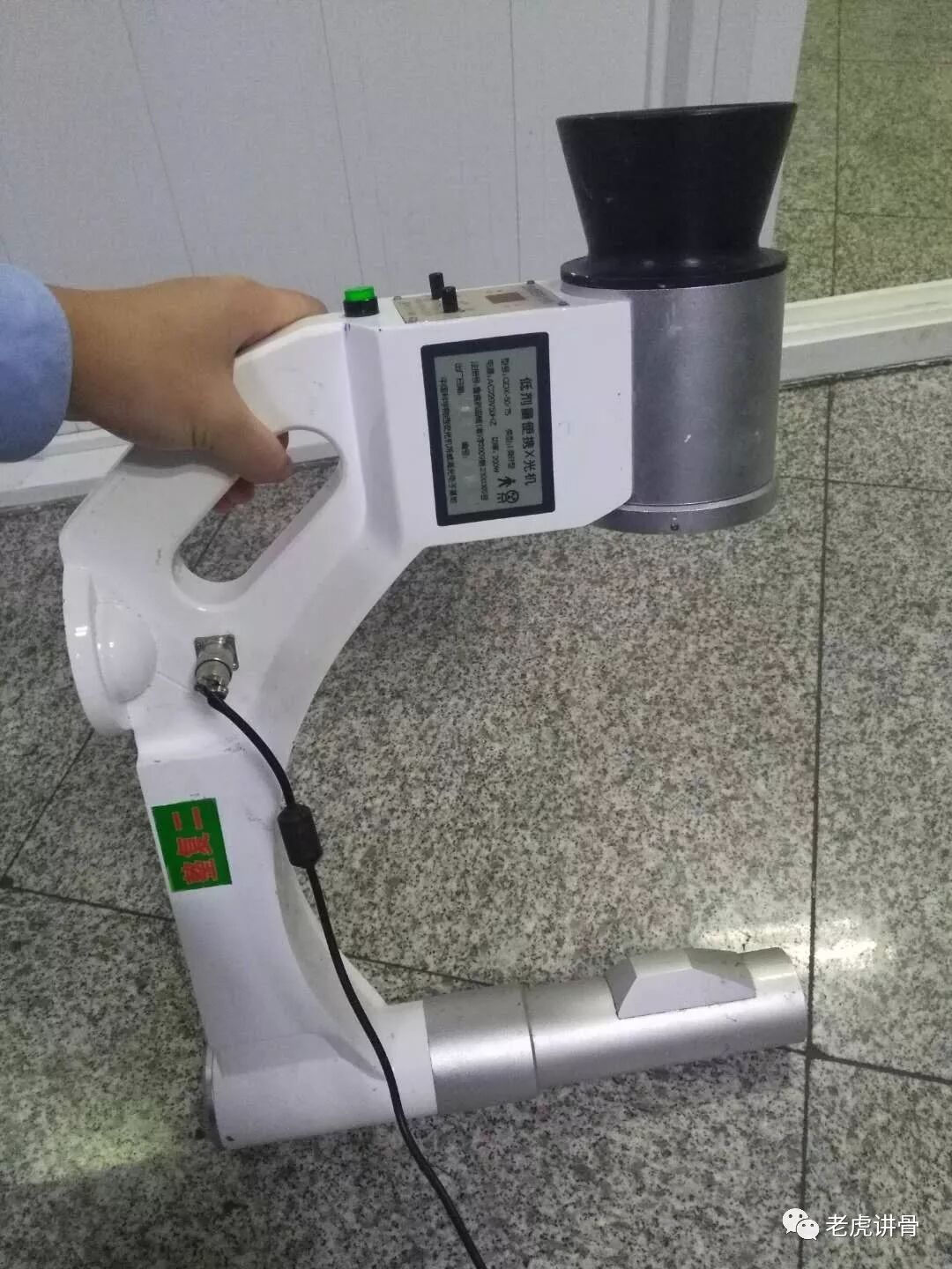 C臂透视怎么实现桡骨远端骨折：C臂机透视真的有助于复位吗？_https://www.jmylbn.com_新闻资讯_第2张