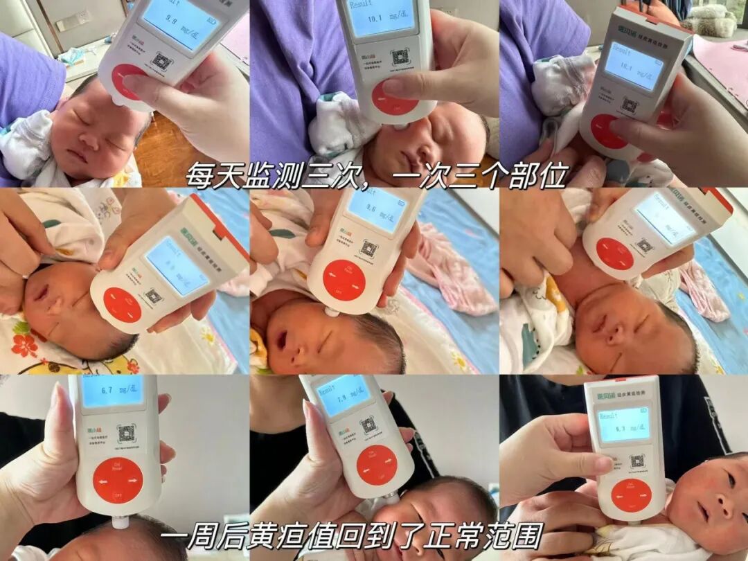 测黄疸仪器怎么测量宝妈们！给宝宝测黄疸，你还在频繁跑医院吗？_https://www.jmylbn.com_新闻资讯_第14张