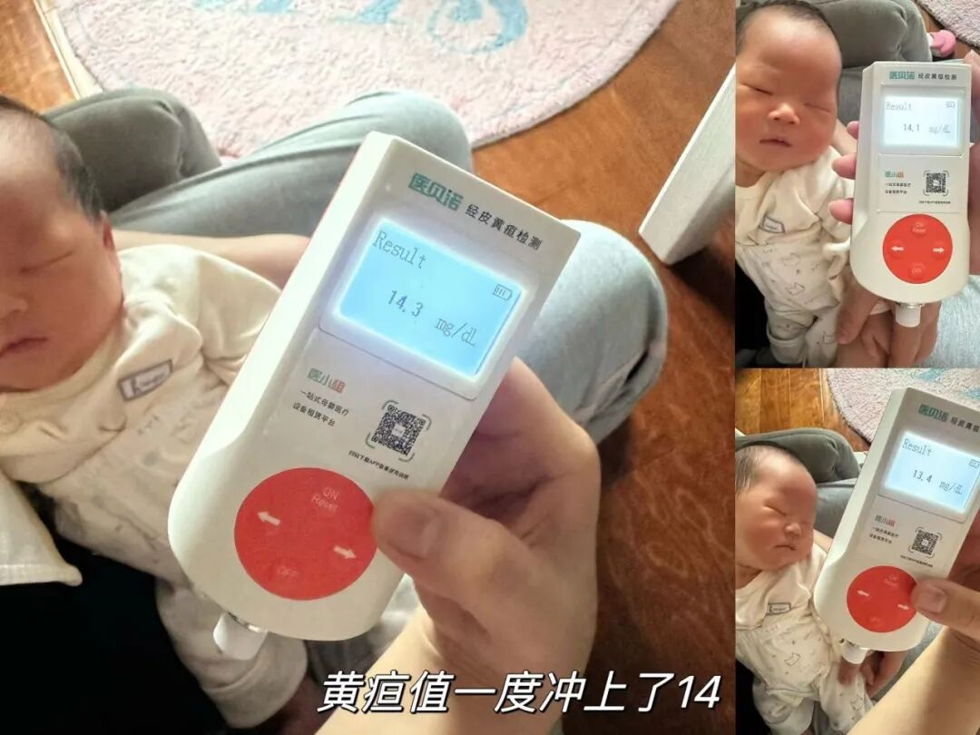 测黄疸仪器怎么测量宝妈们！给宝宝测黄疸，你还在频繁跑医院吗？_https://www.jmylbn.com_新闻资讯_第13张
