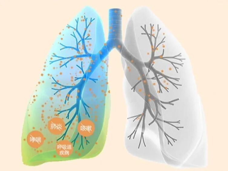 医用口含雾化器怎么用宝宝咳嗽痰多，雾化缓解咳嗽也太快了吧！_https://www.jmylbn.com_新闻资讯_第5张