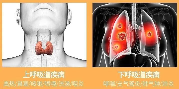 医用口含雾化器怎么用宝宝咳嗽痰多，雾化缓解咳嗽也太快了吧！_https://www.jmylbn.com_新闻资讯_第4张