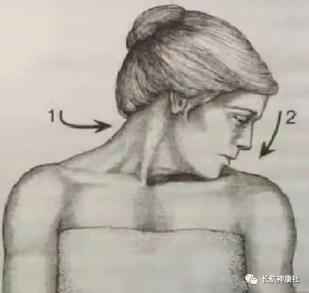 易忽视又易被误诊的颈肩痛——斜角肌综合征