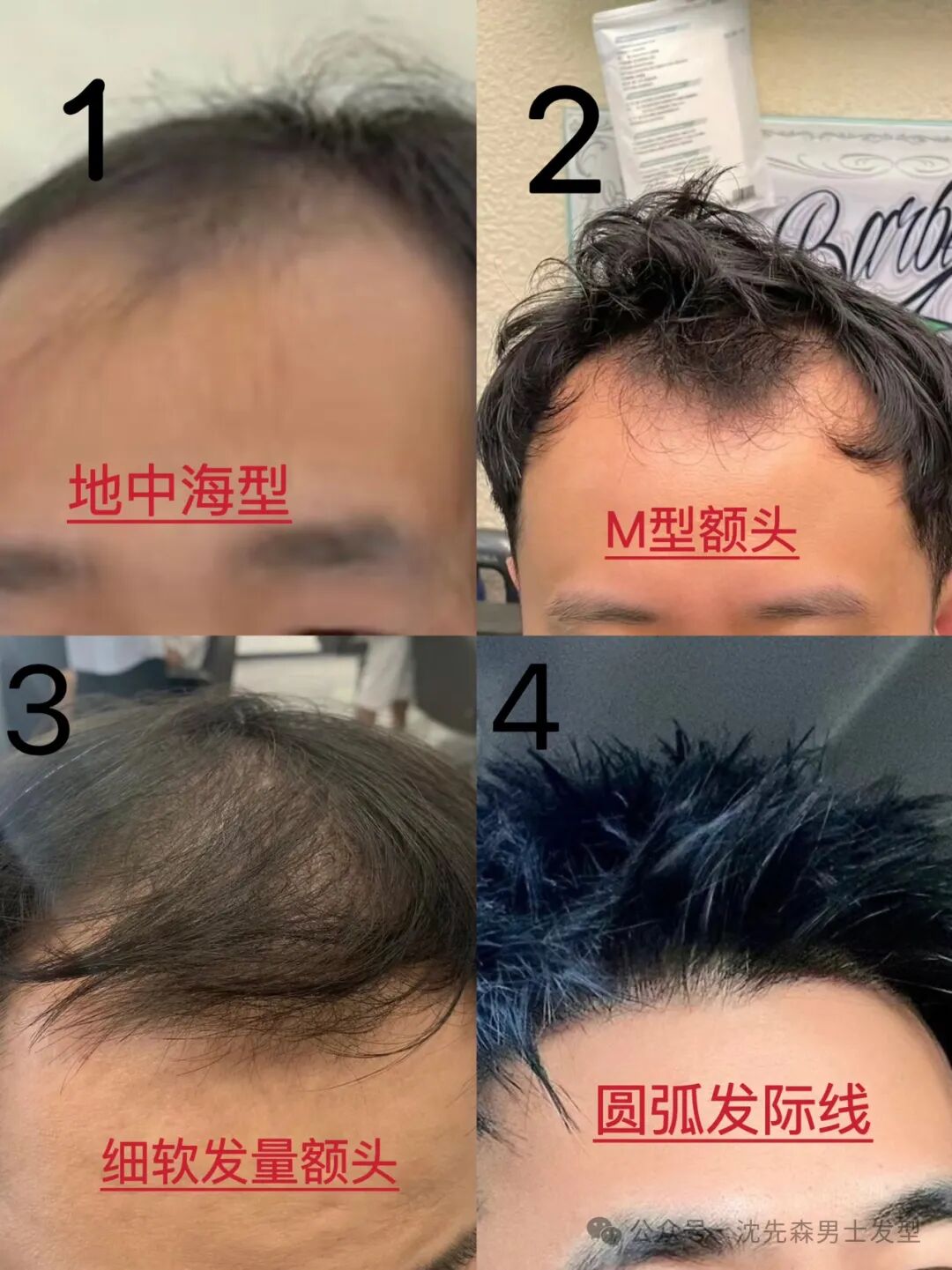 男士发型看懂这4类高额头发际线类型，设计发型再也不翻车，立马帅气时尚显发量多