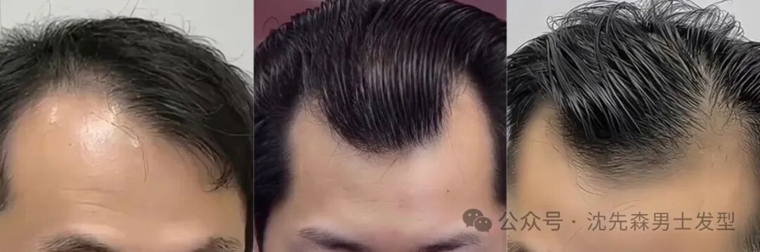 30-40岁男士发际线高不用愁，这几款时尚帅气发型来拯救，帮你重塑魅力风采