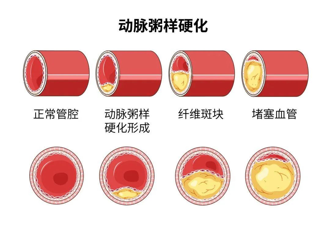 疏通脚部血液循环