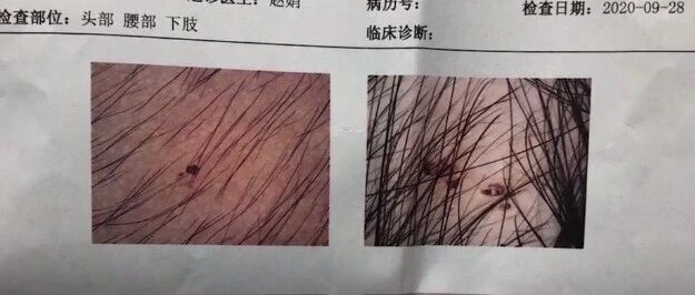 幼儿园里惊现“容嬷嬷”，这三名老师被逮捕！孩子在校被施暴，你应该这样做→