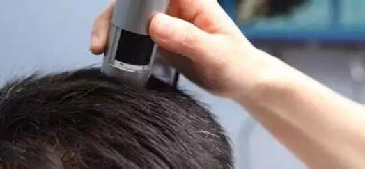 毛囊与毛发的关系你了解多少？