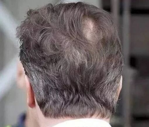 有了白发不要化学染，这个方法能让头发自然柔和，健康，靠谱！